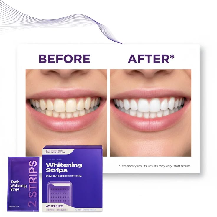 Purple Teeth Whitening Strips - No Sensitivity At-Home Teeth Whitener
